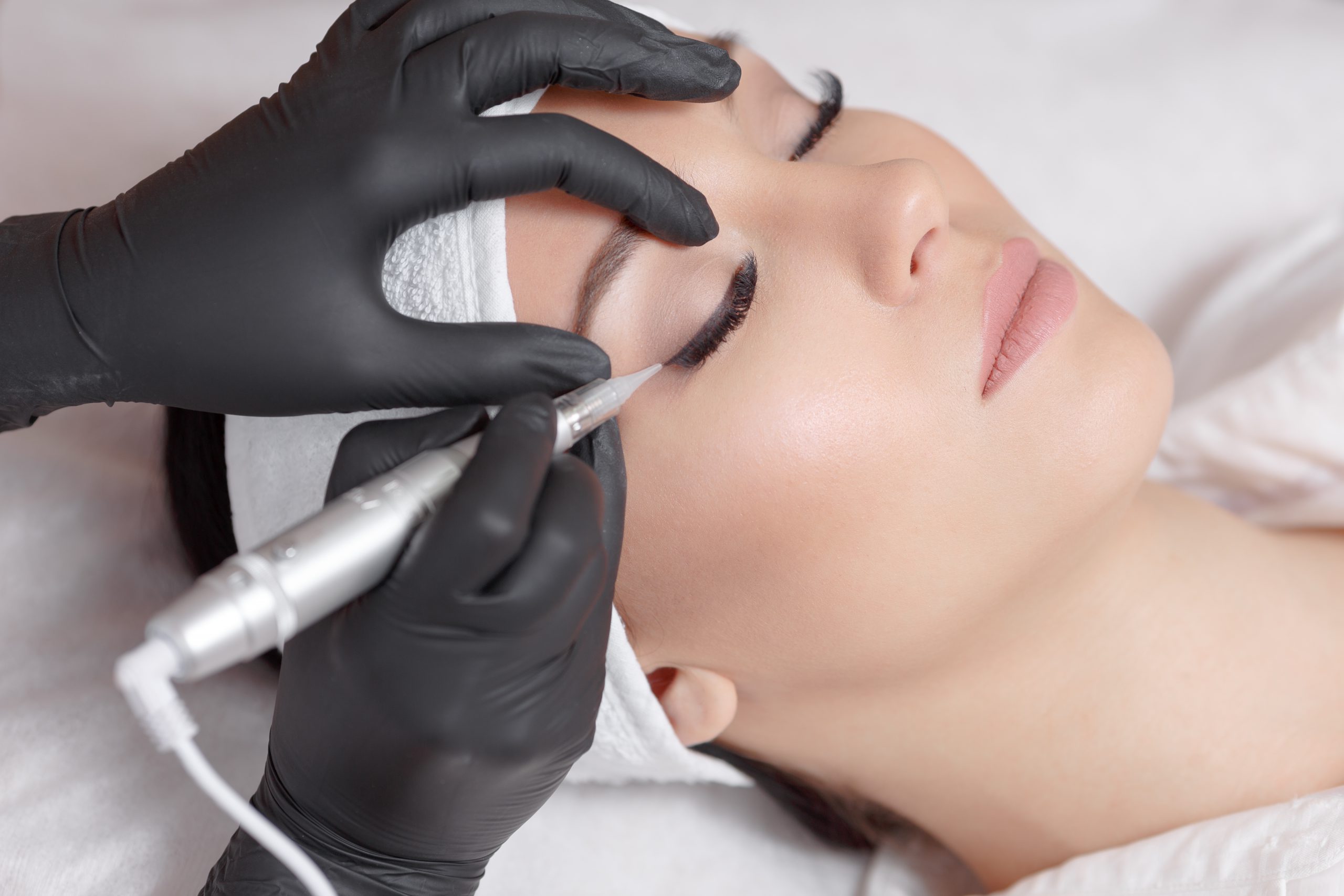 Dermal fillers